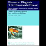 Ultrasound Diagnosis of Cerebrovascular Disease : Doppler Sonography of the Extra and Intracranial Arteries Duplex Scanning