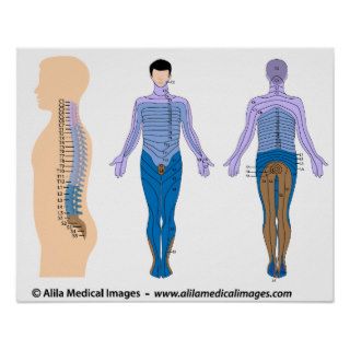 Spinal cord injury basis, medical drawing. print