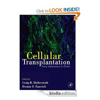 Cellular Transplantation: From Laboratory to Clinic eBook: Craig Halberstadt, Dwaine F. Emerich: Kindle Store