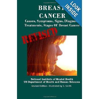 Breast Cancer: Causes, Symptoms, Signs, Diagnosis, Treatments, Stages Of Breast Cancer   Revised Edition   Illustrated by S. Smith: Department of Health and Human Services, National Institutes of Health, National Cancer Institute, S. Smith: 9781470006419: 