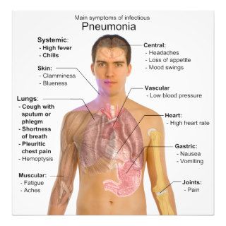 Chart of the Symptoms of Pneumonia Photo Art