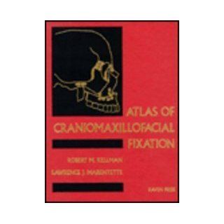 Atlas of Craniomaxillofacial Fixation (9780781700160): Robert M. Kellman, Lawrence J. Marentette: Books
