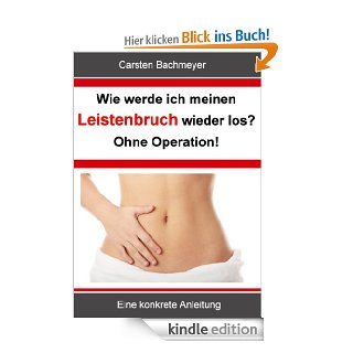 Wie werde ich meinen Leistenbruch wieder los? Ohne Operation!: Eine konkrete Anleitung eBook: Carsten Bachmeyer: Kindle Shop